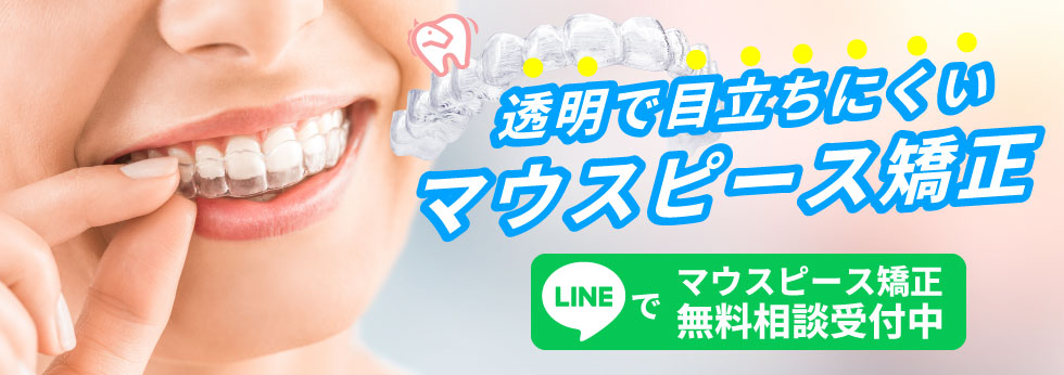 マウスピース矯正